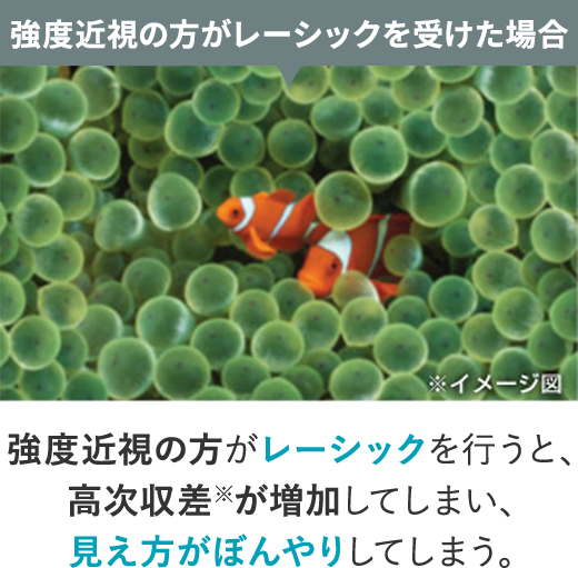 強度近視の方がレーシックを受けた場合