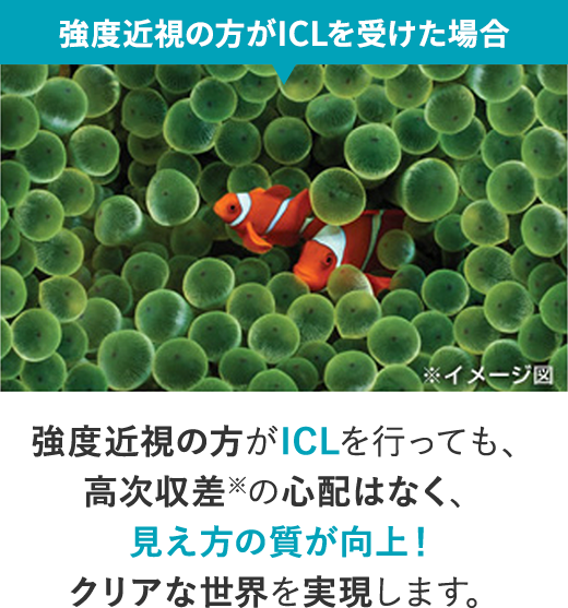 強度近視の方がICLを受けた場合